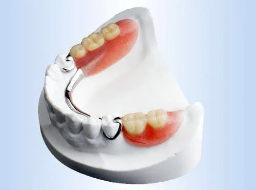 Бюгельные протез